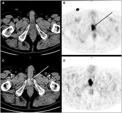 Comprehensive literature review of oral and intravenous contrast-enhanced PET/CT: a step forward?